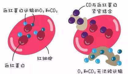 警惕洗澡季隱形殺手 一氧化碳中毒康復(fù)后，當心遲發(fā)性腦病